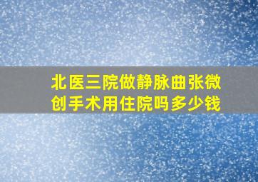 北医三院做静脉曲张微创手术用住院吗多少钱