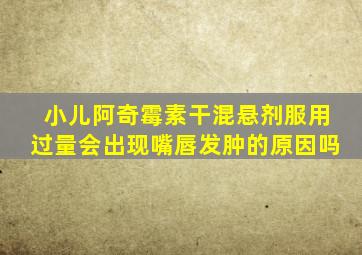 小儿阿奇霉素干混悬剂服用过量会出现嘴唇发肿的原因吗