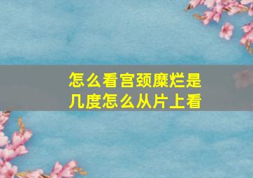 怎么看宫颈糜烂是几度怎么从片上看