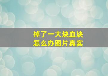 掉了一大块血块怎么办图片真实